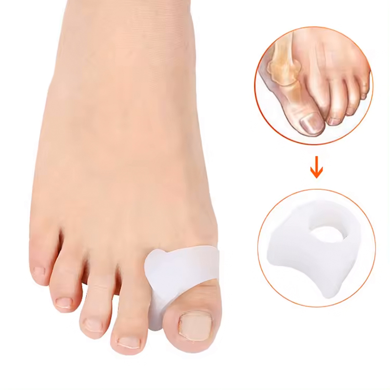Tåring med tåspridare - 2 st - Separera tårna vid hallux valgus
