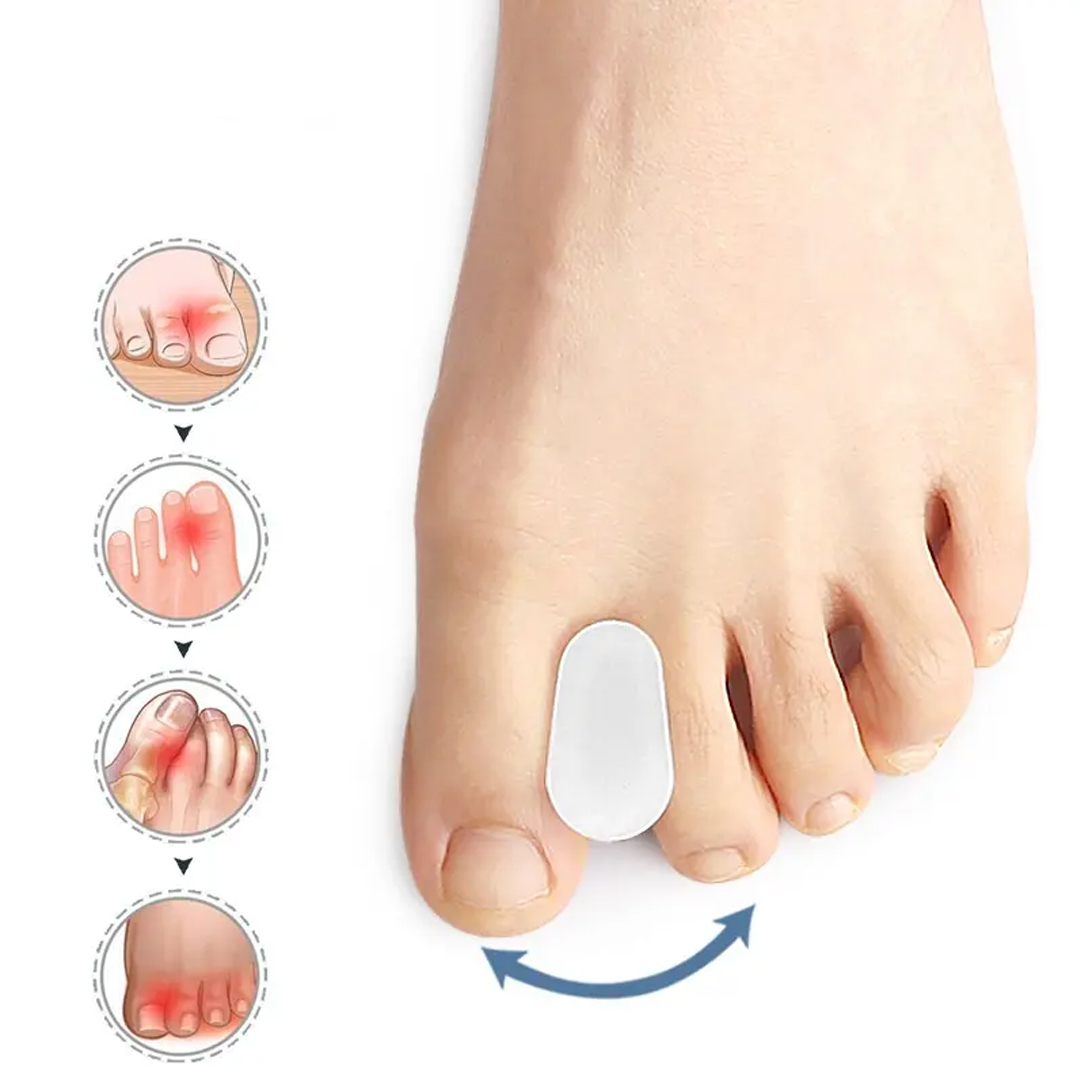 Tåspridare hallux valgus - 2 st, Medium - Separerar tårna för att minska smärta